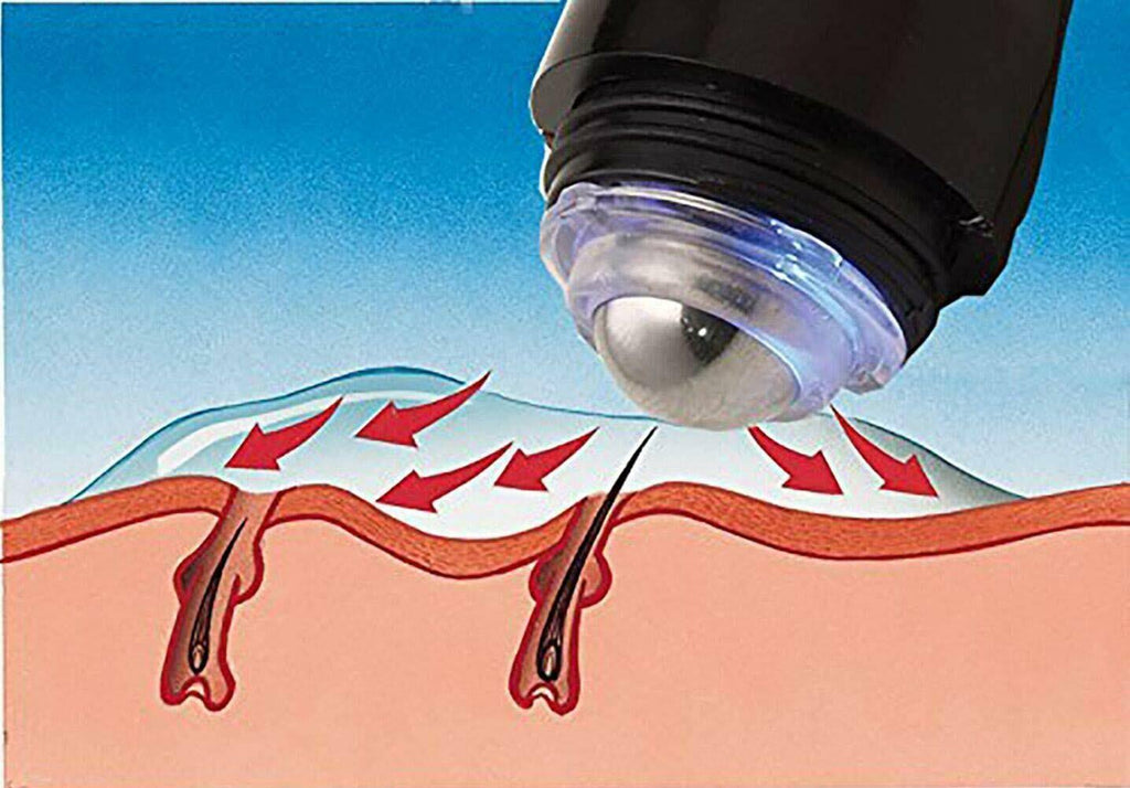 Permanent Hair Removal Epilation System E154888